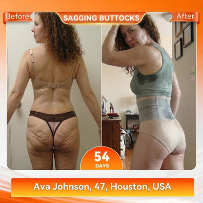 Moringa & Berberine 4-In-1 Micro-Particle sculpting & Fat-Burn shorts